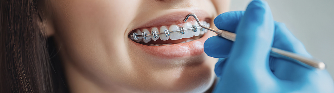 Orthodontics